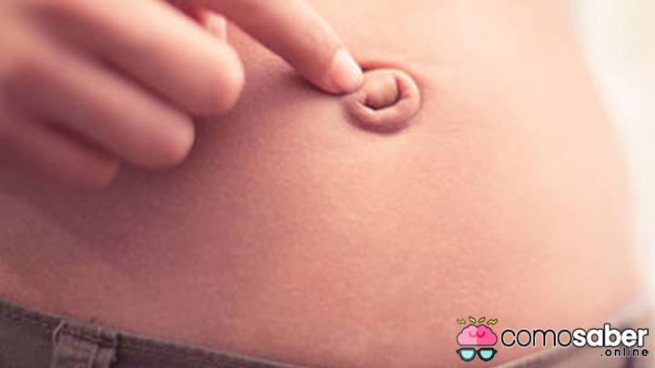 como saber si tengo una hernia umbilical